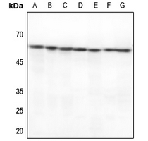 1 - Anti-HSP60 Antibody [KO/KD Validated] AP51271
