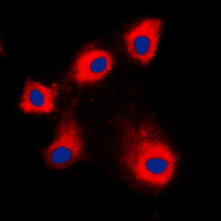 3 - Anti-HSPE1 Antibody AP51272