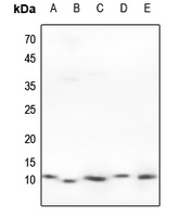 1 - Anti-HSPE1 Antibody AP51272