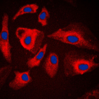 3 - Anti-HSPH1 Antibody [KO/KD Validated] AP51273