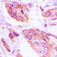 19 - Anti-HSPH1 Antibody [KO/KD Validated] AP51273