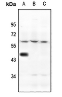 1 - Anti-5-HT1A Antibody AP51274