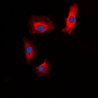 3 - Anti-Amylin Antibody AP51276