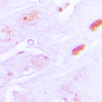 19 - Anti-Amylin Antibody AP51276