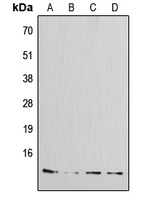 1 - Anti-Amylin Antibody AP51276