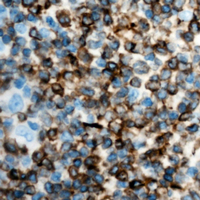 19 - Anti-IFN gamma Antibody AP51278
