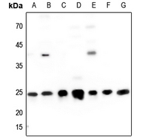 1 - Anti-IFN gamma Antibody AP51278