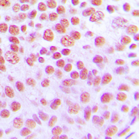 19 - Anti-Cytokine IK Antibody AP51280
