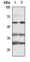 1 - Anti-Cytokine IK Antibody AP51280