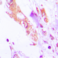 19 - Anti-IL-1 beta Antibody AP51281