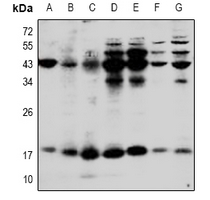 1 - Anti-IL-1 beta Antibody AP51281