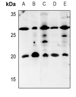 1 - Anti-IL-5 Antibody AP51282