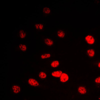 3 - Anti-IP6K2 Antibody AP51285
