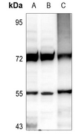 1 - Anti-IP6K2 Antibody AP51285