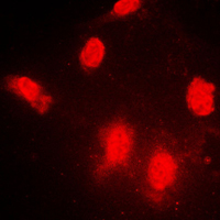 3 - Anti-IPPK Antibody AP51286