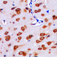 19 - Anti-IPPK Antibody AP51286