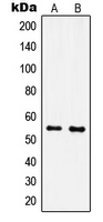 1 - Anti-IPPK Antibody AP51286