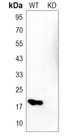 0 - Anti-CD49e LC Antibody [KO/KD Validated] AP51289