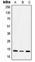 1 - Anti-CD49e LC Antibody [KO/KD Validated] AP51289