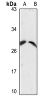 1 - Anti-CD49f LC Antibody AP51290