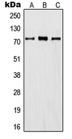 1 - Anti-ITIHC1 Antibody AP51293