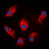 3 - Anti-Involucrin Antibody AP51294