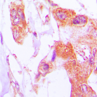 19 - Anti-Involucrin Antibody AP51294