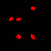 3 - Anti-KAT7 Antibody AP51295