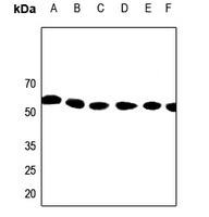 1 - Anti-Kv1.1 Antibody AP51296
