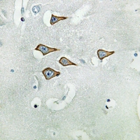19 - Anti-Kv3.1 Antibody AP51297