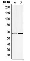 1 - Anti-Kv3.1 Antibody AP51297