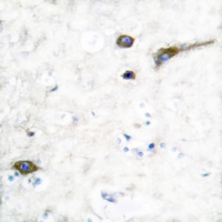 19 - Anti-Kv3.2 Antibody AP51298