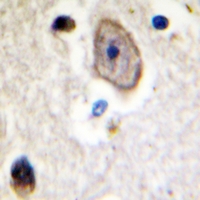 19 - Anti-Kv3.4 Antibody AP51299