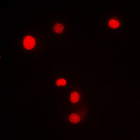 3 - Anti-KLF11 Antibody AP51301