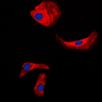 3 - Anti-Kallikrein 3 Antibody AP51303