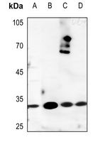1 - Anti-Kallikrein 3 Antibody AP51303