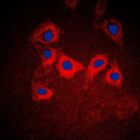 3 - Anti-Cytokeratin 10 Antibody AP51305