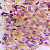 19 - Anti-Cytokeratin 10 Antibody AP51305