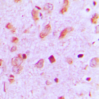 19 - Anti-Cytokeratin 13 Antibody AP51306