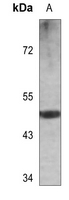 1 - Anti-Cytokeratin 13 Antibody AP51306