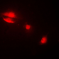 3 - Anti-Cytokeratin 14 Antibody AP51307