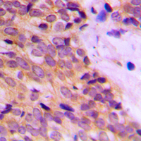19 - Anti-Cytokeratin 14 Antibody AP51307