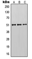 1 - Anti-Cytokeratin 14 Antibody AP51307