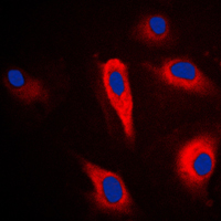 3 - Anti-Cytokeratin 16 Antibody AP51308