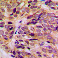 19 - Anti-Cytokeratin 16 Antibody AP51308
