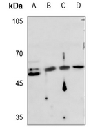 1 - Anti-Cytokeratin 16 Antibody AP51308