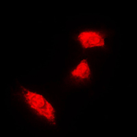 3 - Anti-Cytokeratin 18 Antibody AP51309