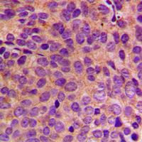 19 - Anti-Cytokeratin 18 Antibody AP51309