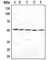 1 - Anti-Cytokeratin 18 Antibody AP51309