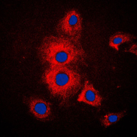3 - Anti-Cytokeratin 19 Antibody AP51310